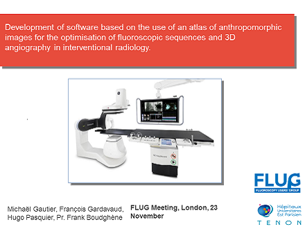 FLUG 2017 – Development of a software based on an anthropomorphic image atlas for image quality optimization in interventional radiology: initial results for 3D angiography; Michaël Gautier